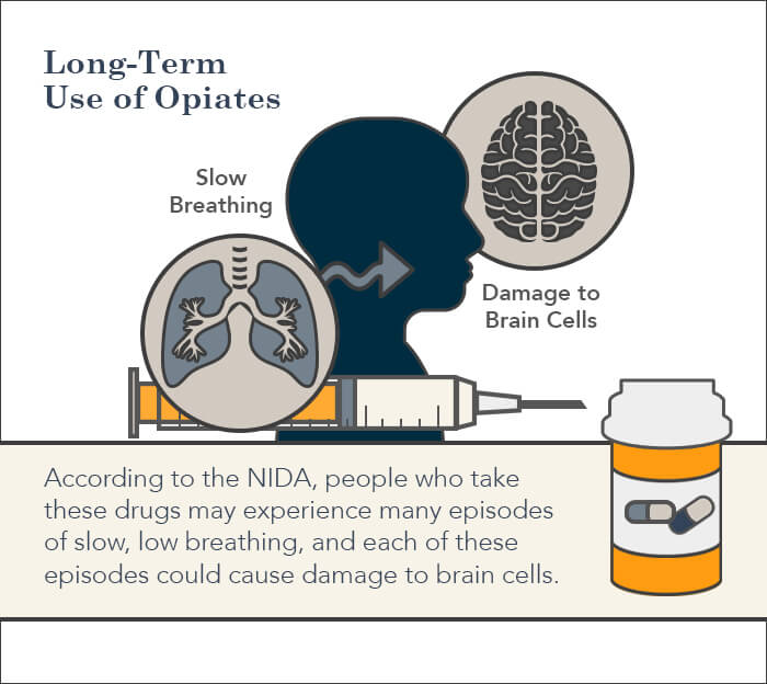 opiate abuse