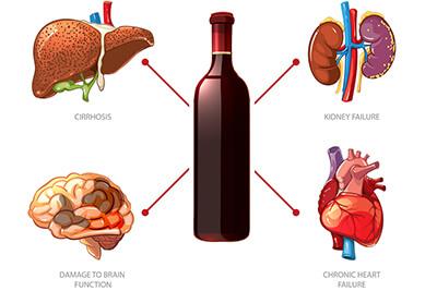 Side Effects of Alcohol Abuse and Chronic Drinking - Agape Treatment