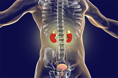 Principle of management of rt flank pain